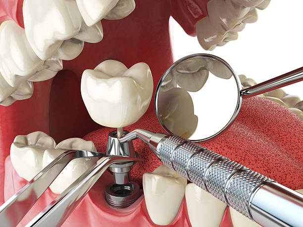 Best Emergency Broken Tooth Repair in Mount Olive, MS