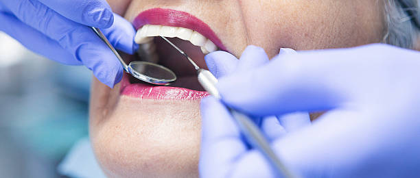 Best Emergency Root Canal Treatment in Mount Olive, MS